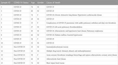 SARS-CoV-2 infection dysregulates the expression of clinically relevant drug metabolizing enzymes in Vero E6 cells and membrane transporters in human lung tissues
